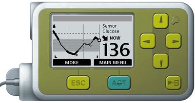 MiniMed pump 3-hour view showing glucose trends