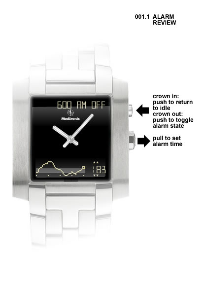 Medtech in a Minute: COVID-19 Impacts Medtronic, Conformis Ends Furlou